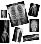 Human X-Rays Anatomy